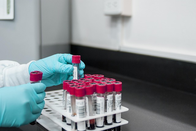 Tube de sang pour analyse du taux de ferritine en laboratoire ferritine Tube de sang pour analyse du taux de ferritine en laboratoire ferritine